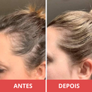 Escova de Terapia Capilar 4 em 1 - CAPILUX | Menos Queda, Mais Força!